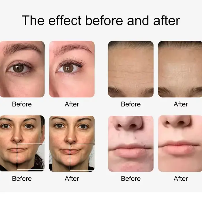 Hydro Machine à oxygène et eau 12 en 1, Lifting du visage, nettoyage en profondeur, Dermabrasion, Pe